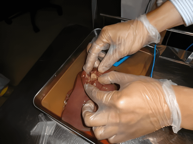 豚の肝臓を使用したラジオ波焼灼療法のトレーニング風景